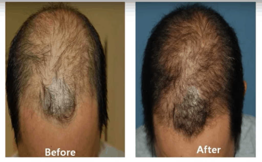 hair before and after !