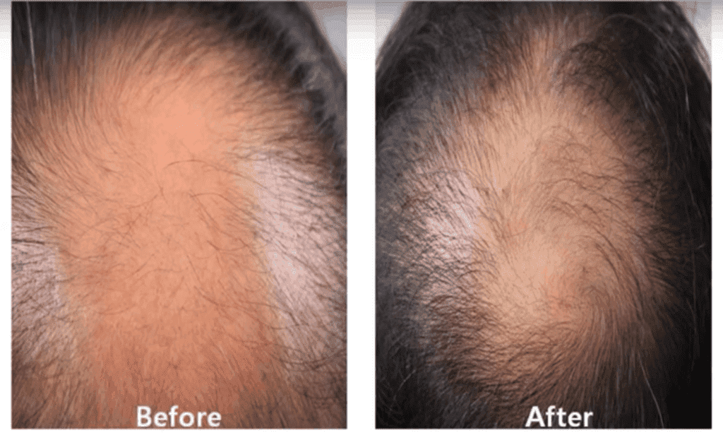 hair before and after