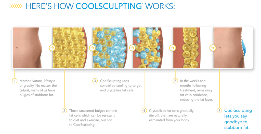 How-Coolsculpting-Works